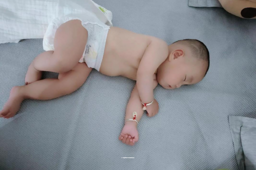 威海六个月宝宝眼睛散光